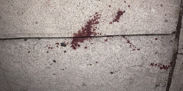 Norwood: Man Hospitalized after Stabbing on East 207th Street, Three Males Sought