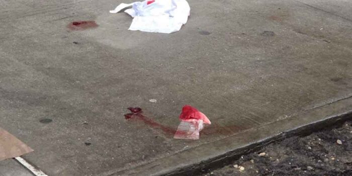 UPDATE Bedford Park: Man Hospitalized after Morning Stabbing on East 198th Street after Dispute